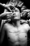 -- injured